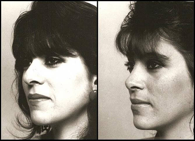 Plastic Surgery in New York City | Call Us (646) 470-0918