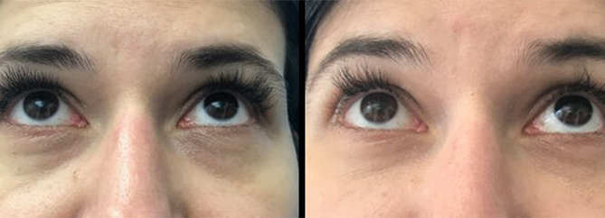 Non Invasive Cosmetics in New York City | Call 646-470-0918 | Barry M Weintraub, MD, FACS